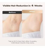Moehair Professional MO-9080 جهاز إزالة الشعر بتقنية IPL للاستخدام المنزلي لتقليل نمو الشعر وإزالته تدريجياً من الجسم وتحت الإبطين
